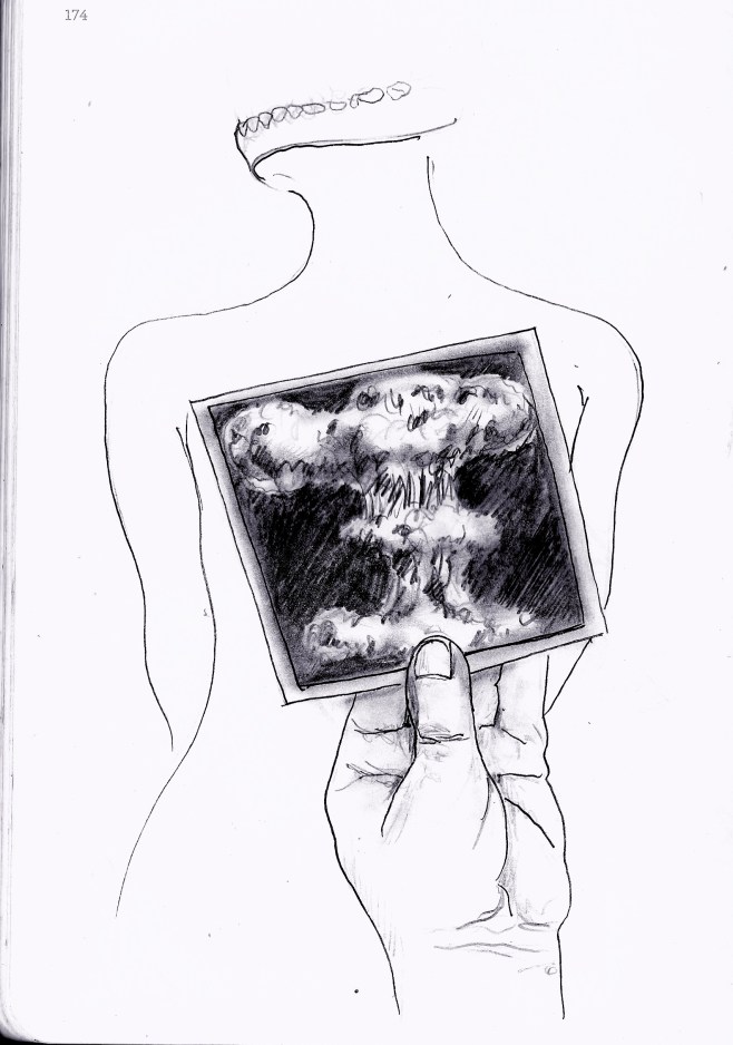 I've got your chest X-Ray - 2014